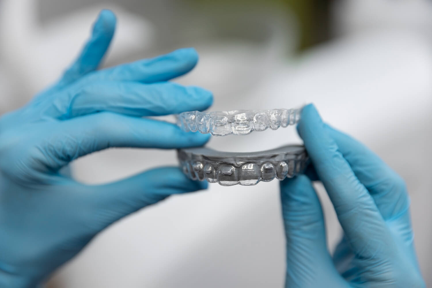 Dentista com luvas azuis segura alinhadores invisíveis transparentes, mostrando a tecnologia e previsibilidade do tratamento em Brasília.